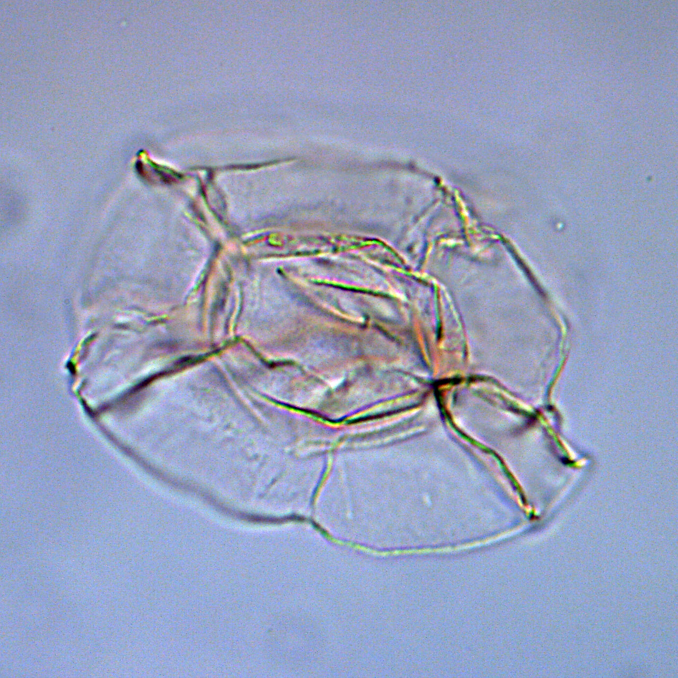 Impagidinium velorum, 1410B-11H-3, 115-117, C36-4, foto-d.jpg